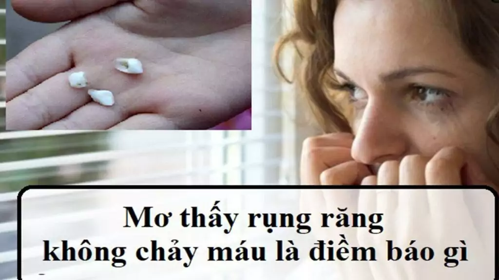 Nằm chiêm bao thấy rụng răng không chảy máu