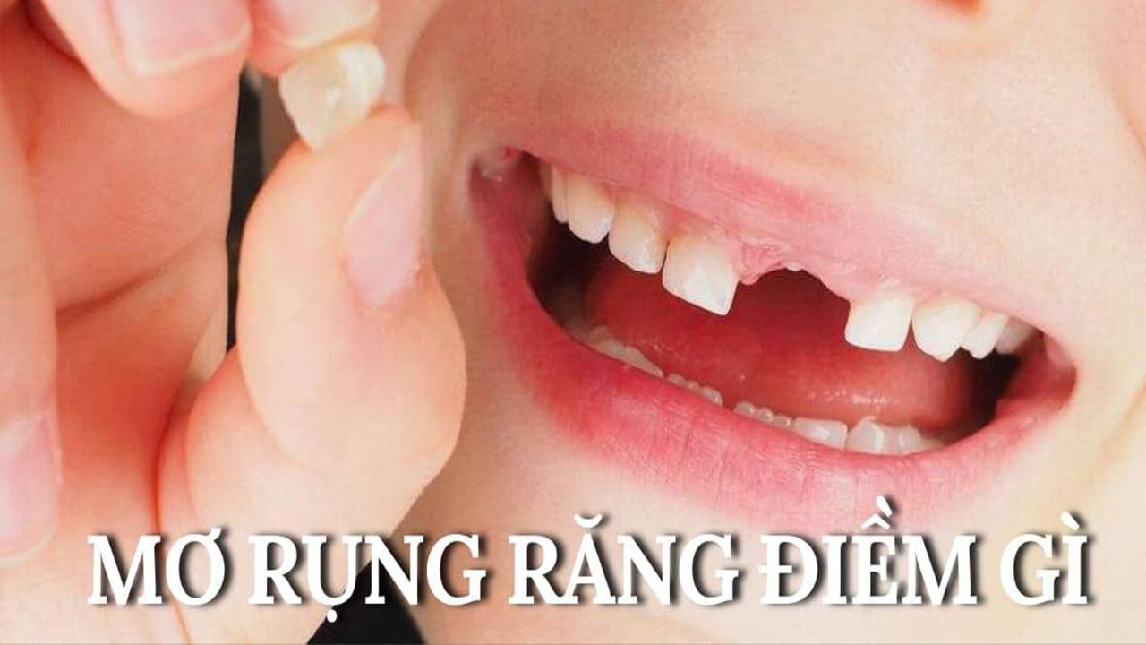 Nằm chiêm bao thấy gãy răng cửa đánh số mấy?